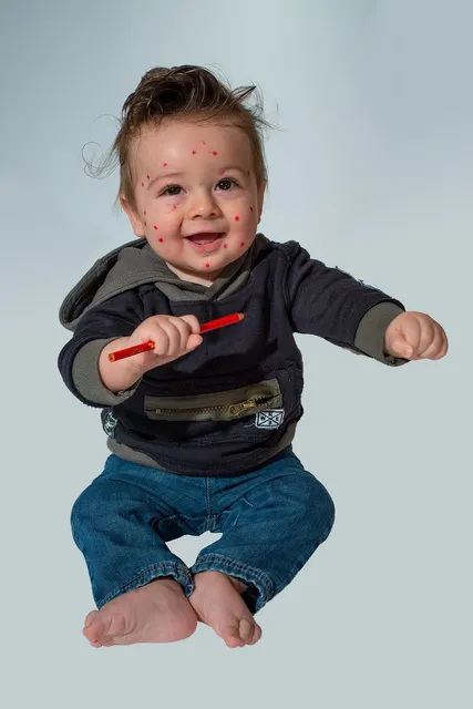 Varicella vaccine adults